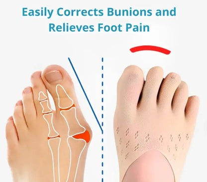 Bunion Corrective Toe Socks