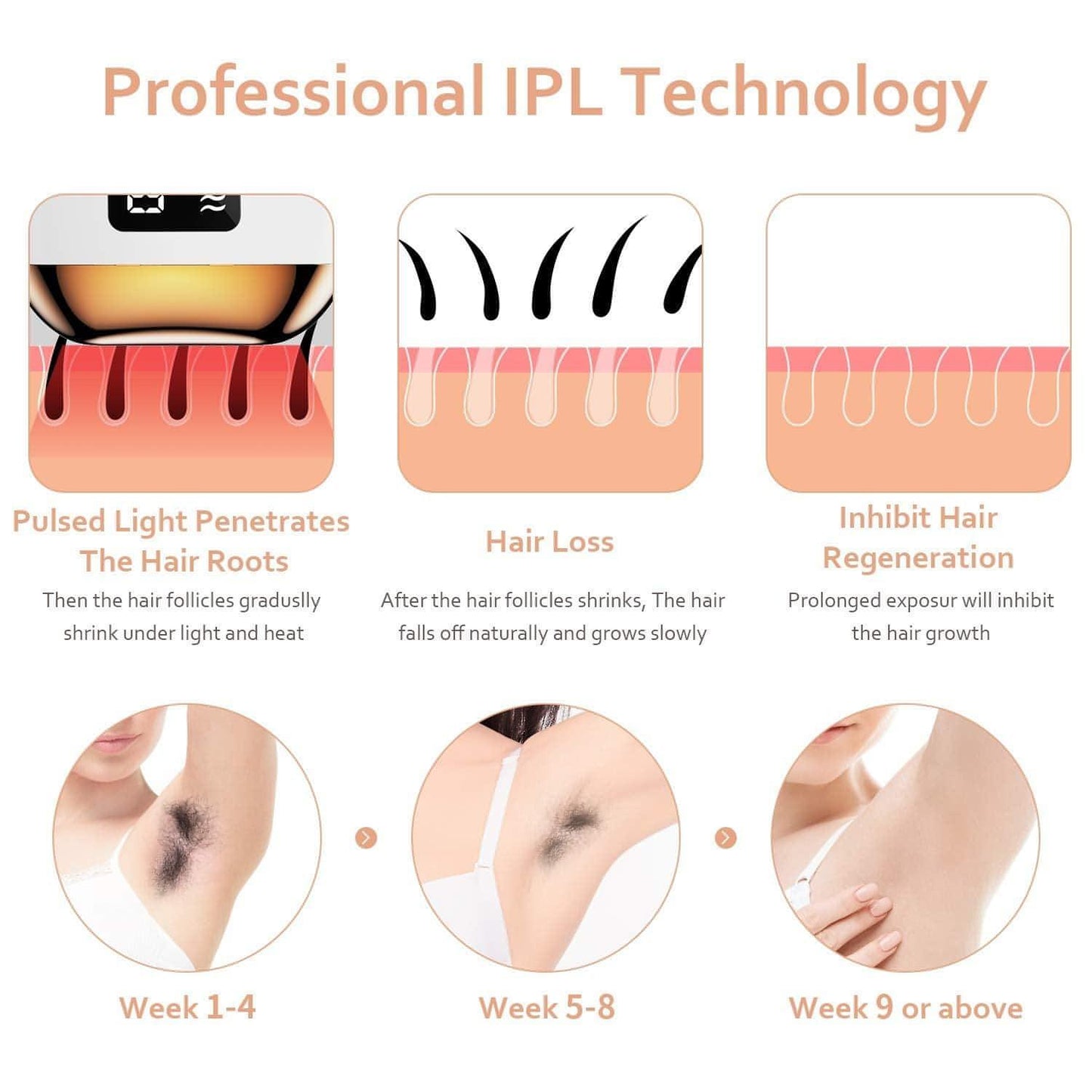 IPL Laser Hair Removal Device | Permanent Hair Remover On Face, Legs, Arms, Armpits, Whole Body | Use at Home