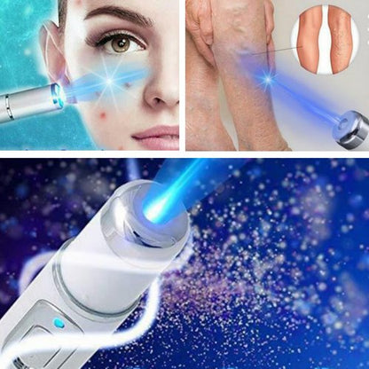 Spider Veins Removal Pen - Blue Light Treatment Laser Pen Soft Acne Scars Wrinkle Removal Visible Clear Light Therapy